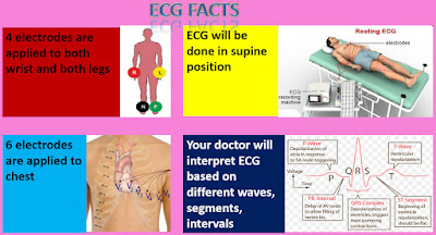 FACTS ABOUT ECG