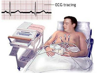 ECG PROCEDURE IN HYDERABAD