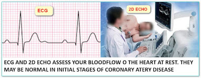 ADVANTAGES OF TREADMILL TEST OVER ECG AND 2D CHO