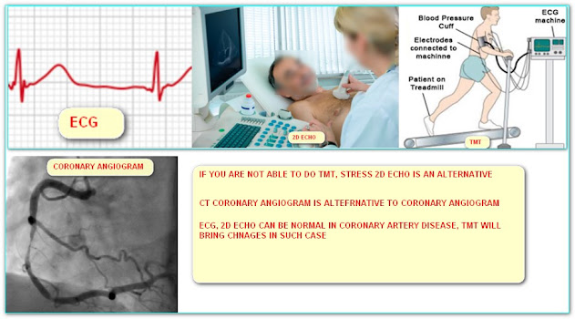 HOW TO DIAGNOSE CORONARY ARTERY DISEASE