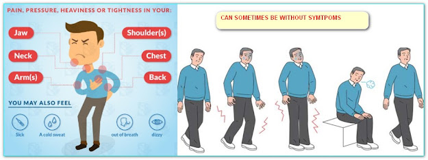 SYMPTOMS OF CORONARY ARTERY DISEASE