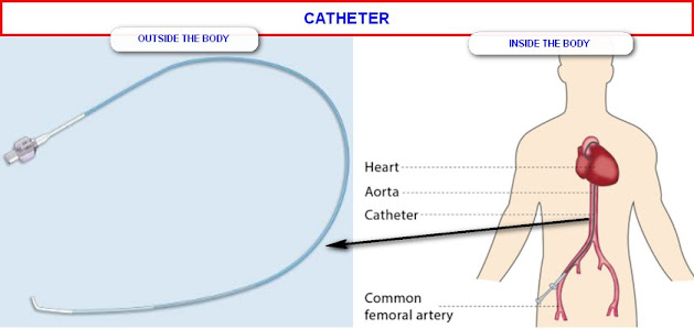 SHEATH FOR FEMORAL CORONARY ANGIOGRAM