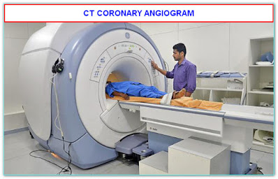 CT CORONARY ANGIOGRAM IS AN ALTERNATIVE TO CAG