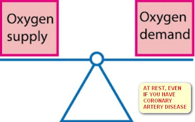 CORONARY ARTERY DISEASE