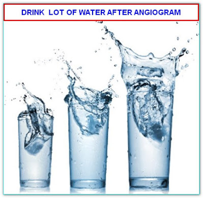 FLUIDS AFTER CORONARY ANGIOGRAM