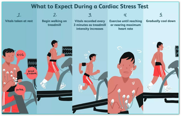 WHAT TO EXPECT DURING TREADMILL TEST
