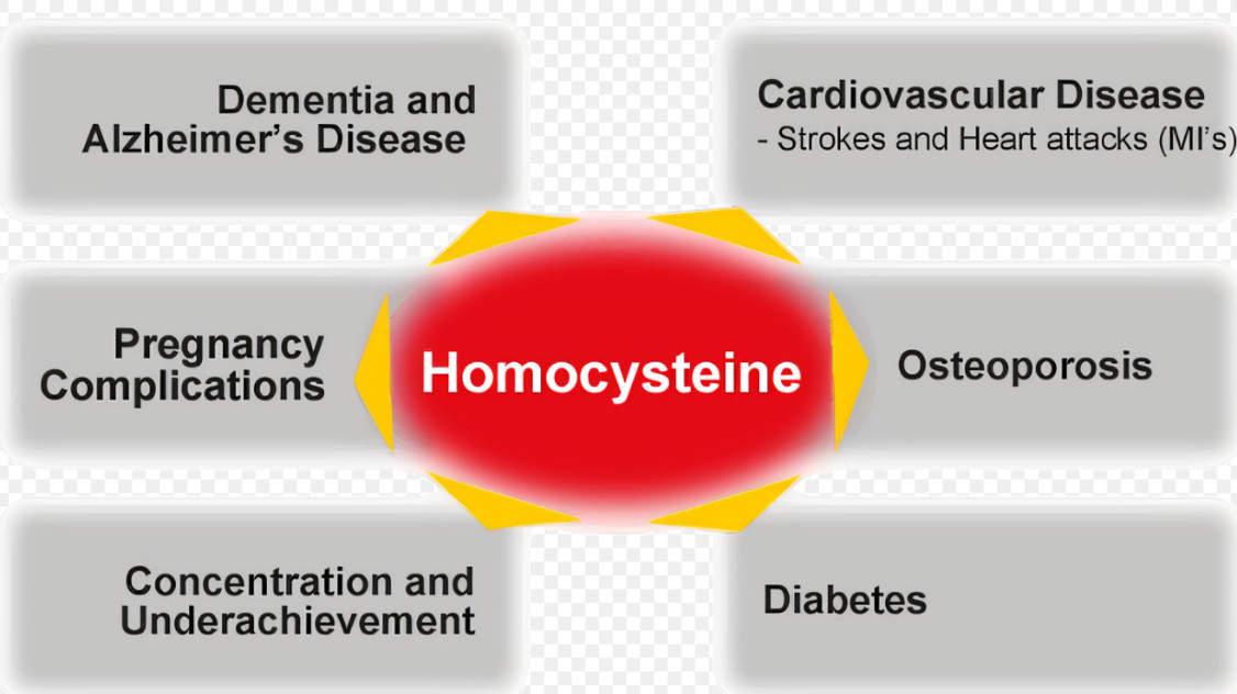 Infographics-Diseases associated with High homocysteine levels