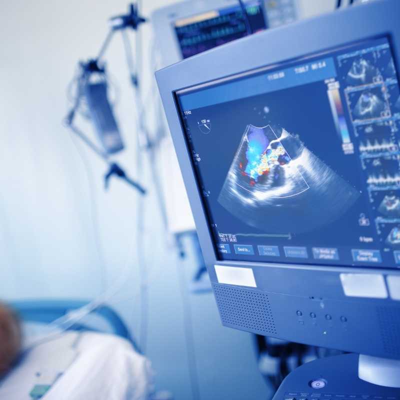 2d-echo-test-cost-2-d-echocardiography-tests-in-india