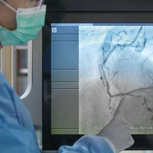 angiogram test-dr D. Malleswara Rao